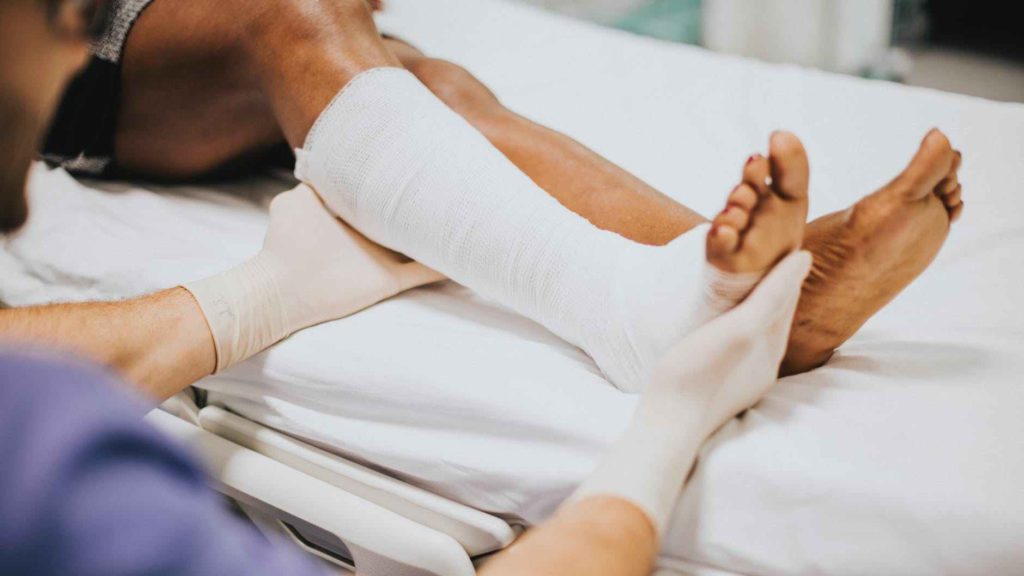 a person's leg with a bandaged leg