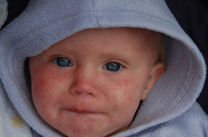 a baby with blue eyes