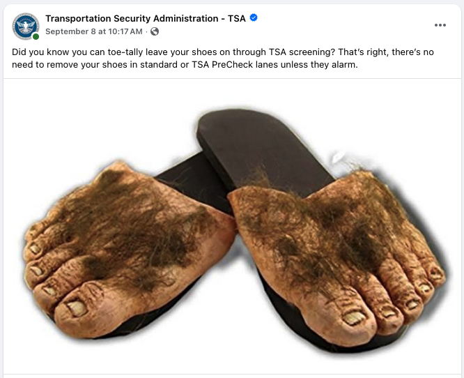a pair of hairy feet